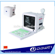 portable ultrasonic diagnostic device & ultrasound scan machine